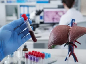 Approfondimento clinico sugli anticorpi anti muscolo liscio